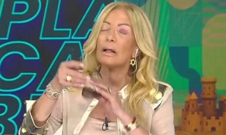 Cómo le quedó la cara a Susana Roccasalvo luego de sufrir una infección en la vista
